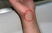 Bệnh viện Trung ương Quân đội 108 phát cảnh báo về 1 căn bệnh nguy hiểm, nhà nào cũng có nguy cơ mầm mống trú ngụ