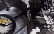 Rửa bát, tay người đàn ông chảy máu xối xả, phải khâu 4 mũi: Bác sĩ cảnh báo thói quen nhiều người mắc