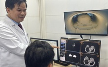 Bộ Y tế lên tiếng về việc BHYT không thanh toán X-quang dưới 6 phút