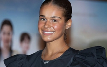 Nhờ bức ảnh "quá xấu để đăng lên MXH", nữ diễn viên 22 tuổi phát hiện ra căn bệnh nguy hiểm