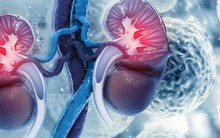 Thận xuống cấp nhanh chóng nếu ăn quá nhiều 9 loại thực phẩm này: Toàn món khoái khẩu của nhiều người