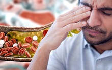 Nhìn vào mặt cũng có thể biết mỡ máu cao hay không: Nếu thấy 2 dấu hiệu này, hãy đi khám ngay