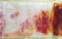 Đổ xô săn si cảnh bán làm thuốc chữa bệnh ung thư