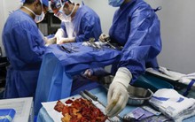 Sự thật ghê sợ sau nhan sắc bốc lửa của Venezuela