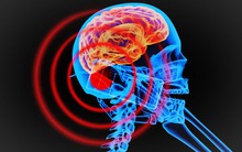 Điện thoại nào có hại cho sức khỏe người dùng nhất?