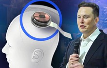 Elon Musk: ‘Công ty của tôi tự tin cấy chip vào não người trong 6 tháng tới’