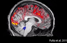 Điều gì xảy ra với não bộ khi bạn đang ngủ?