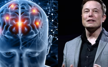 Triển vọng thử nghiệm cấy chip của công ty Neuralink Triển vọng thử nghiệm cấy chip của công ty Neuralink