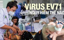 Virus gây bệnh tay chân miệng đã trở lại: EV71 nguy hiểm thế nào? Virus gây bệnh tay chân miệng đã trở lại: EV71 nguy hiểm thế nào?