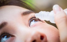 Tự chữa đau mắt tại nhà, cô gái mất thị lực Tự chữa đau mắt tại nhà, cô gái mất thị lực