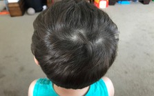 Trẻ có 3 xoáy tóc cá tính, thông minh hơn người? Nghiên cứu khoa học đưa ra câu trả lời ít ai tin