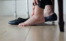 Khi thận suy hỏng, bàn chân có thể xuất hiện 6 điểm bất thường