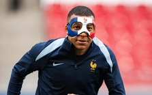 Ngôi sao tuyển Pháp lộ diện với chiếc mặt nạ chuẩn "Ninja Rùa" sau khi nhập viện vì gãy mũi, liệu rằng có đá trận với Hà Lan?