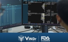 Đạt chuẩn FDA khắt khe, sản phẩm AI của VinBigdata rộng cửa kinh doanh trên toàn cầu