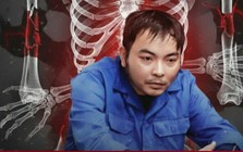 Cựu cán bộ y tế cầm đầu đường dây tự đánh vỡ xương trục lợi 6 tỷ đồng bảo hiểm