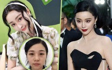 37 ca phẫu thuật, gần 30 tỷ đồng và cái kết cay đắng của người phụ nữ muốn trở thành Phạm Băng Băng thứ hai