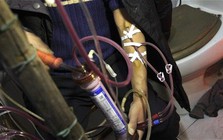 Nam kỹ sư 26 tuổi đột ngột phát hiện suy thận giai đoạn 4 kể: "Tôi chỉ đi khám đau ngón chân thôi mà!"