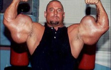 VĐV thể hình sở hữu “cánh tay quái dị” nhất thế giới, sự thật phía sau khiến tất cả ngỡ ngàng