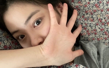 4 bất thường cho thấy cơ thể chị em tích tụ đầy độc tố bác sĩ khuyên: Ăn 4 thứ và làm 3 việc