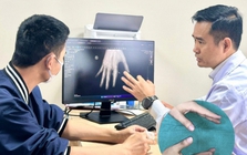 BV Việt Đức tạo nên kỳ tích đầu tiên tại Việt Nam: cứu sống ngón tay bị đứt rời sau 25 giờ