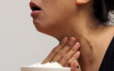 Bị nghẹn họng kéo dài tưởng bệnh dạ dày, người phụ nữ vô tình phát hiện tuyến giáp đã UNG THƯ