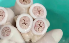 Vụ “lòng se điếu”: TP HCM đang lấy mẫu kiểm nghiệm