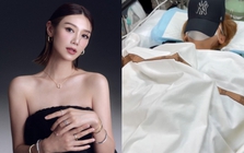 1 Hoa hậu 8X nhập viện cấp cứu vì đột ngột mất thị giác sau khi đắp mặt nạ dưỡng da