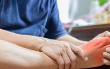 Hai dấu hiệu điển hình của bệnh Chikungunya để phân biệt với sốt xuất huyết Hai dấu hiệu điển hình của bệnh Chikungunya để phân biệt với sốt xuất huyết