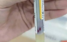 Máu "đặc quánh như sữa chua" vì 3 thú vui nhiều người có Máu "đặc quánh như sữa chua" vì 3 thú vui nhiều người có