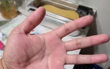 Dù giữa mùa hè, đổ mồ hôi nhiều ở 4 bộ phận này thì... trong người đầy bệnh!