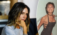 Victoria Beckham đã phải chịu đựng căn bệnh này suốt 25 năm qua
