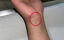 Bệnh viện Trung ương Quân đội 108 phát cảnh báo về 1 căn bệnh nguy hiểm, nhà nào cũng có nguy cơ mầm mống trú ngụ