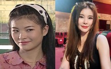 Nữ NSƯT từng đóng vợ anh Núi: U50 chi 1 tỉ đồng sang Hàn đại phẫu nhan sắc, chọn sống độc thân