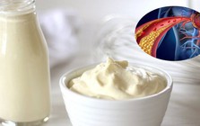 Loại thực phẩm giới trẻ đặc biệt yêu thích nhưng cẩn trọng kẻo gây rối loạn mỡ máu