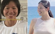 Ánh Viên trước và sau khi niềng răng