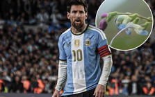 Xuất hiện bông hoa Messi trên thế giới