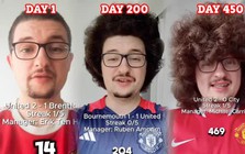 Khổ như fan Manchester United