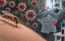 Phát hiện loại virus lần đầu được thấy ở người, bệnh nhân đã tử vong