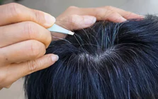 Lời khuyên cho những ai có tóc bạc sớm