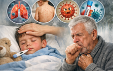 4 bệnh dễ bùng phát trong thời tiết nồm ẩm kéo dài