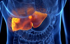 1 dấu hiệu “khó chịu” có thể là tín hiệu cho thấy gan đang suy hỏng nặng: Nếu có cần đi khám ngay