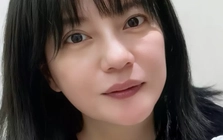 Tình trạng của Triệu Vy