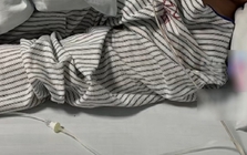 Chàng trai 30 tuổi mắt phải bỗng bị mờ, đi khám bác sĩ kết luận: Hệ miễn dịch đã bị tổn hại hoàn toàn