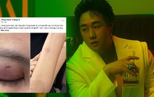 Nóng: Công an vào cuộc vụ ca sĩ Trung Quân Idol bị tố hành hung phụ nữ ở TPHCM