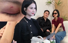 Động thái mới của nữ bác sĩ sau khi Trung Quân idol gặp mặt xin lỗi