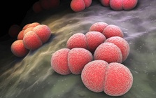 Thêm 2 ca mắc viêm não mô cầu, 1 trẻ tử vong: Cảnh báo nóng người dân cần làm ngay 1 việc