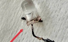 Bác sĩ thót tim gắp đèn LED nằm trong phế quản bé 9 tháng tuổi