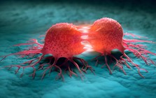 Canada phát triển vi khuẩn “ăn khối u”, mở hướng điều trị ung thư từ bên trong