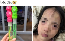 Bé gái 5 tuổi tổn thương mắt sau khi thổi bong bóng xà phòng