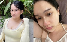 Tình hình hiện tại của Trúc Anh